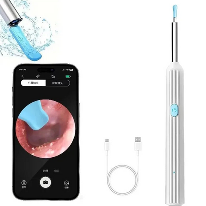 ØreKlar | Trådløs fjernelse af ørevoks med kamera